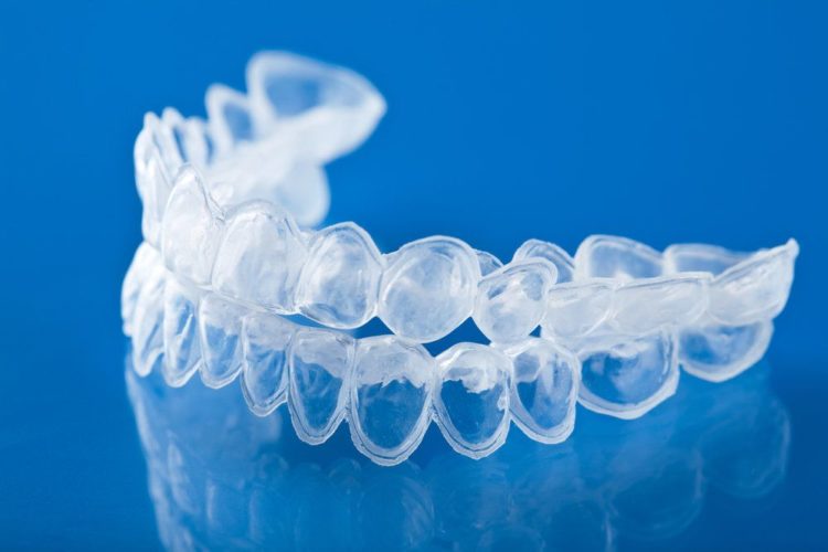 Invisalign Braces