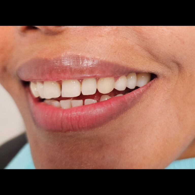 Instagram post from diviachdental. This post is in position 1.