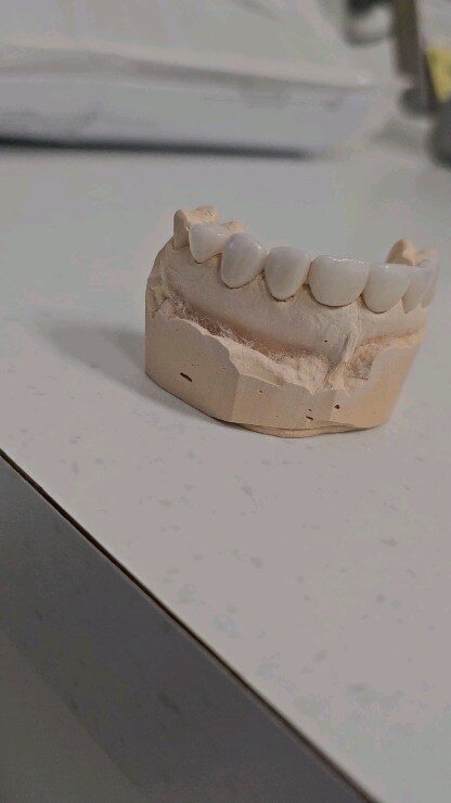 Instagram post from diviachdental. This post is in position 2.