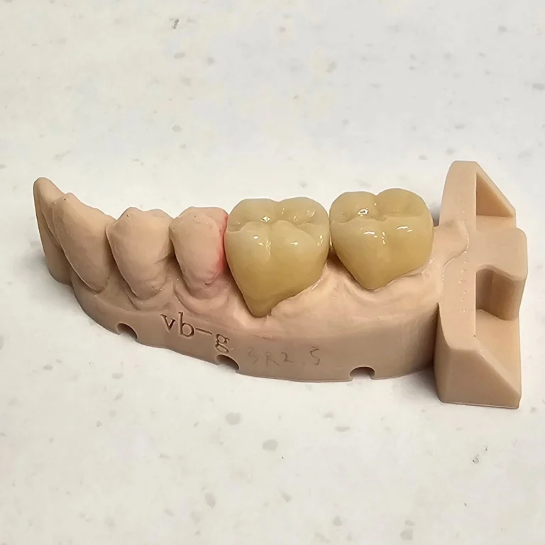 Instagram post from diviachdental. This post is in position 1.