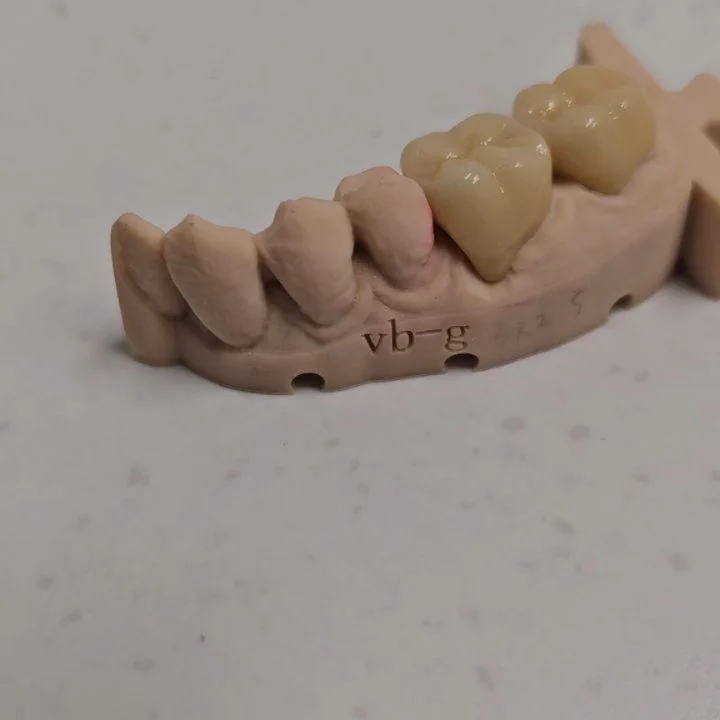 Instagram post from diviachdental. This post is in position 2.