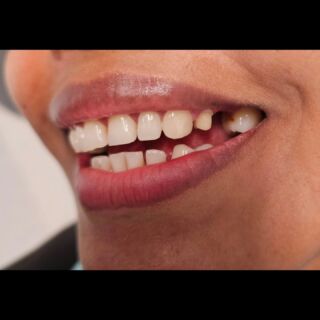 Instagram post from diviachdental. This post is in position 2.