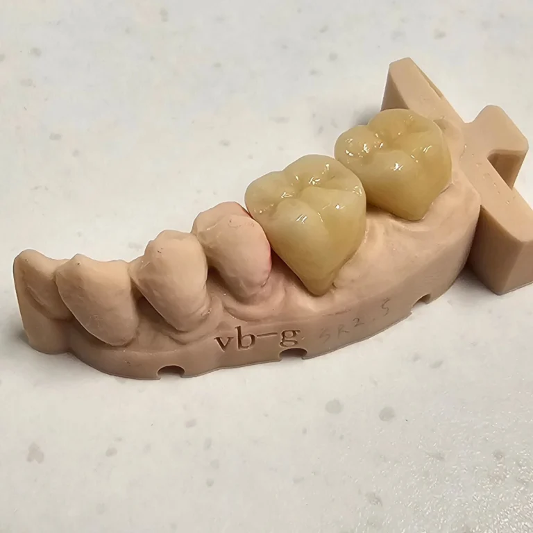 Instagram post from diviachdental. This post is in position 0.